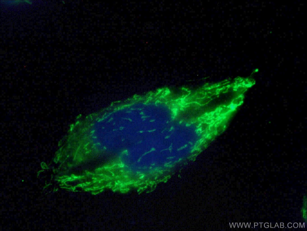 CHCHD10 Polyclonal antibody