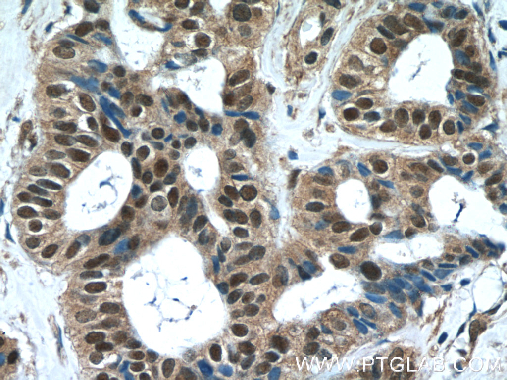 WDR38 Polyclonal antibody