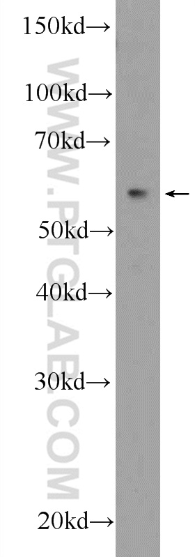 RNFT2 Polyclonal antibody