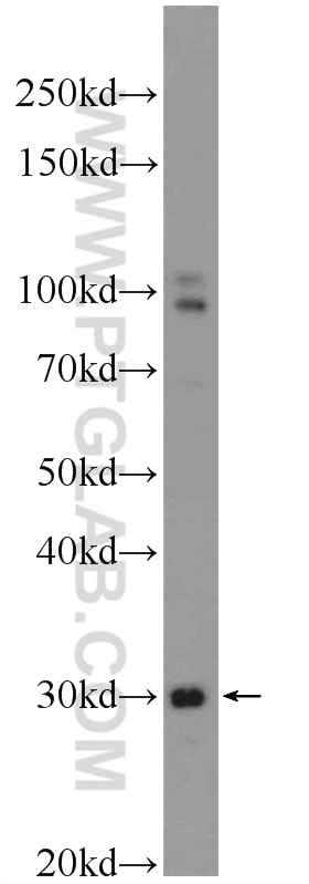 TXNDC11 Polyclonal antibody
