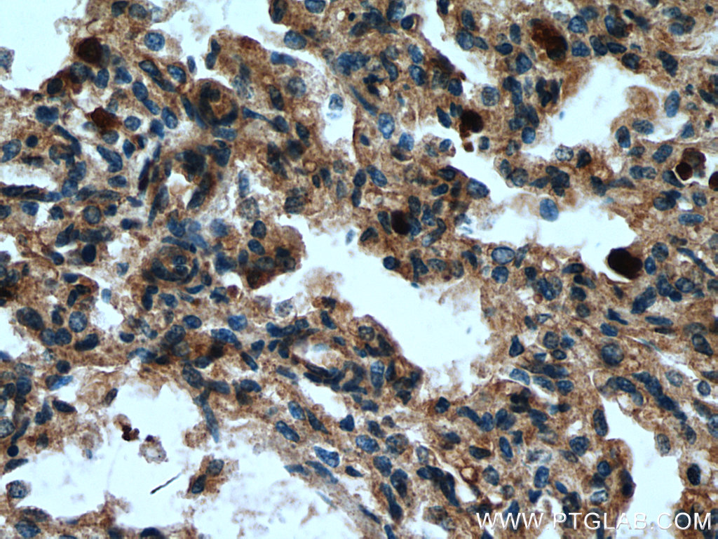 MCEMP1 Polyclonal antibody