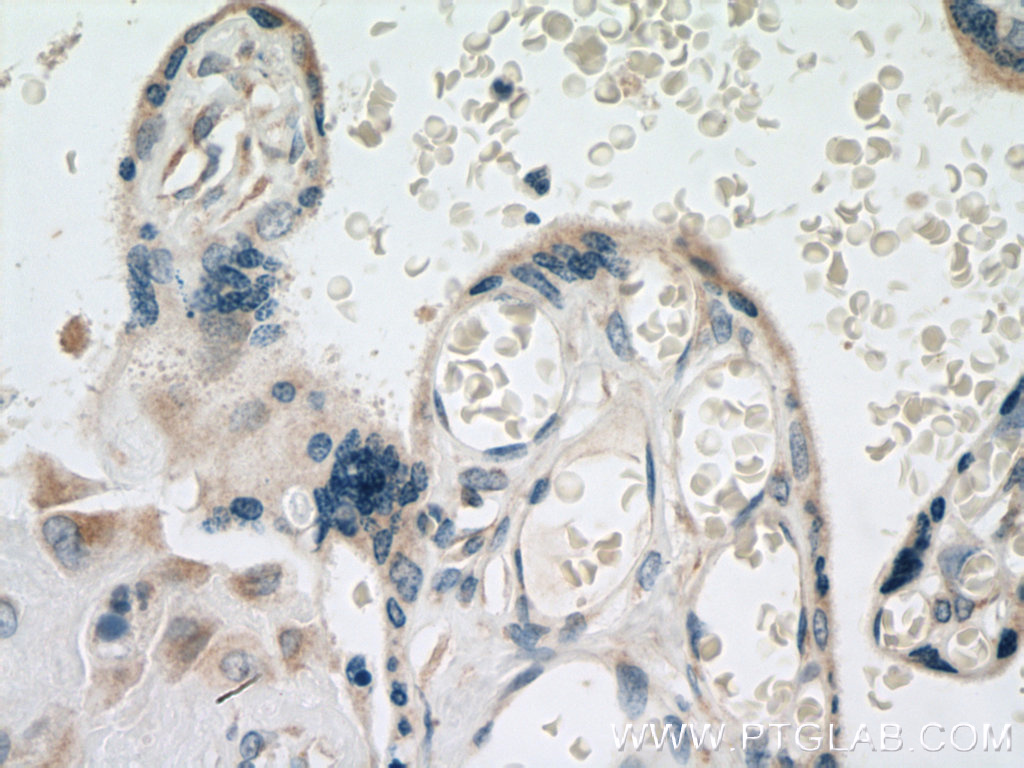 GDPD5 Polyclonal antibody