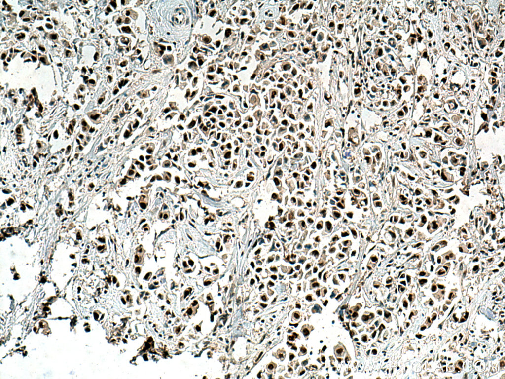 RPUSD2 Polyclonal antibody