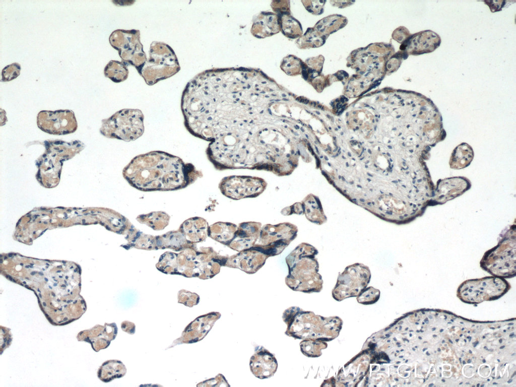 CXorf61 Polyclonal antibody
