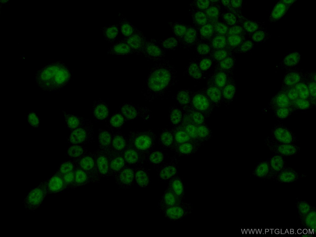 VIRMA/KIAA1429 Polyclonal antibody