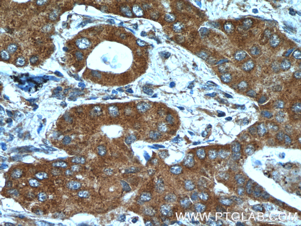 BLOC1S3 Polyclonal antibody