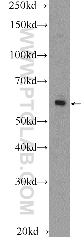 ZNF419 Polyclonal antibody