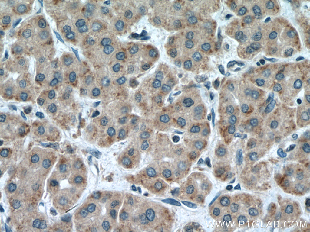 CARNS1 Polyclonal antibody