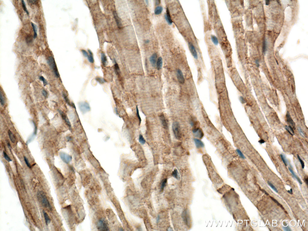 CERK Polyclonal antibody