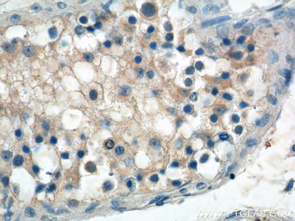 ANKRD13B Polyclonal antibody