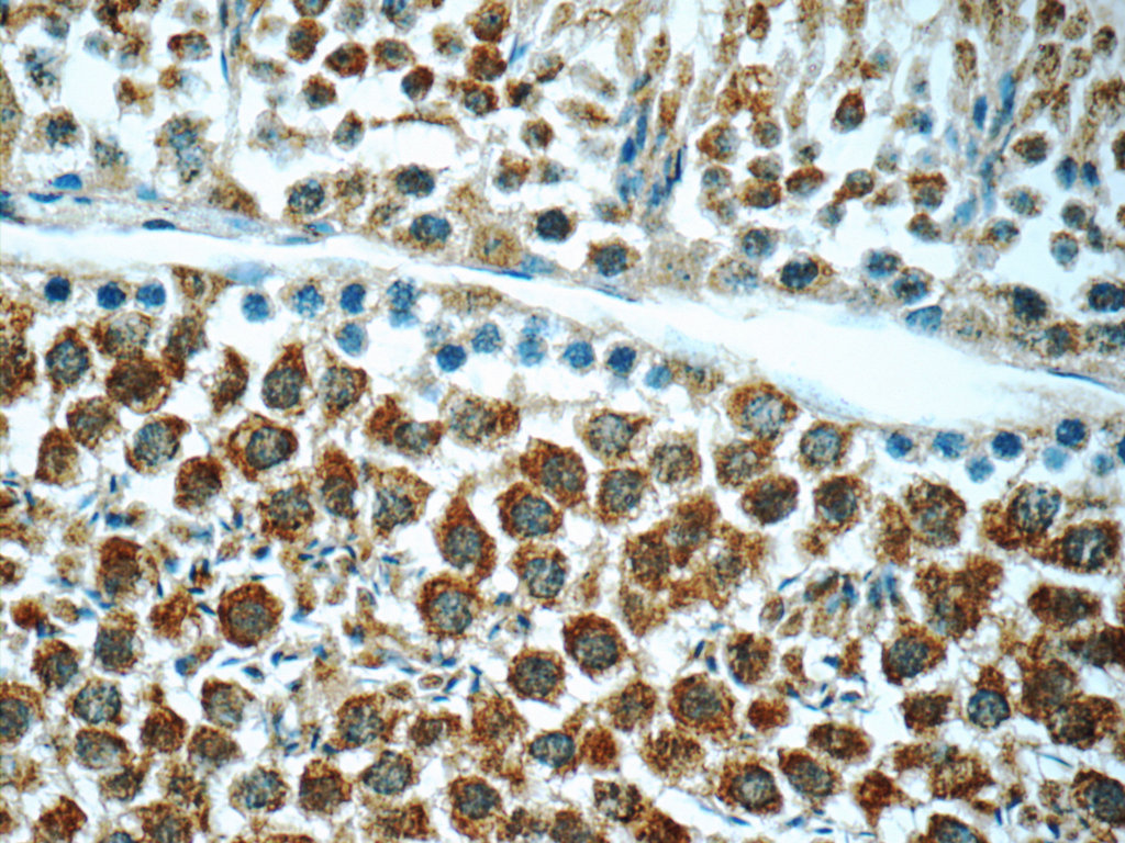 ANKRD54 Polyclonal antibody