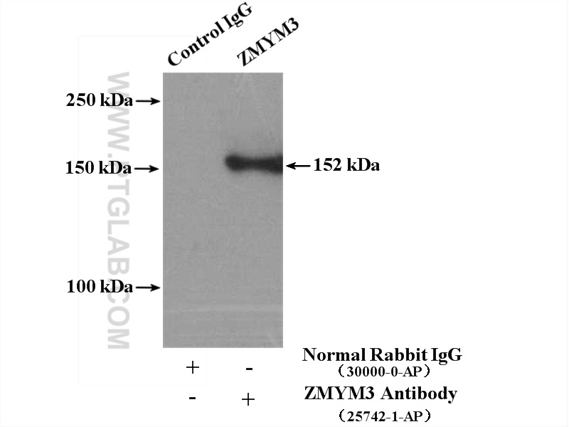 ZMYM3 Polyclonal antibody