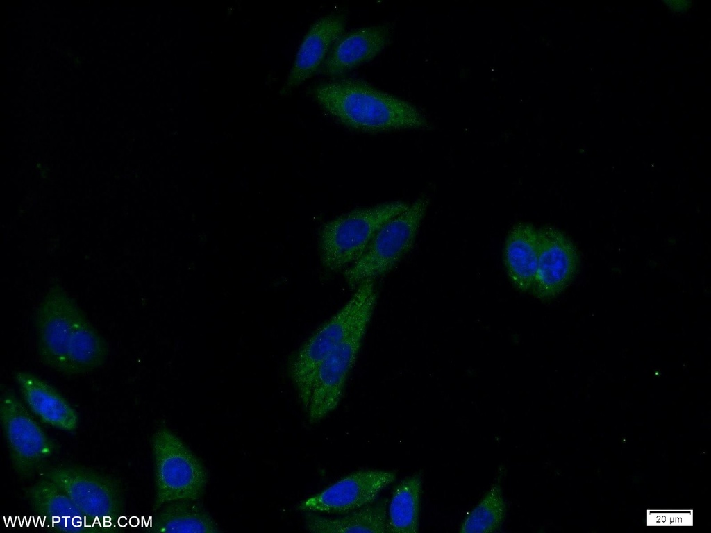 RAPH1 Polyclonal antibody