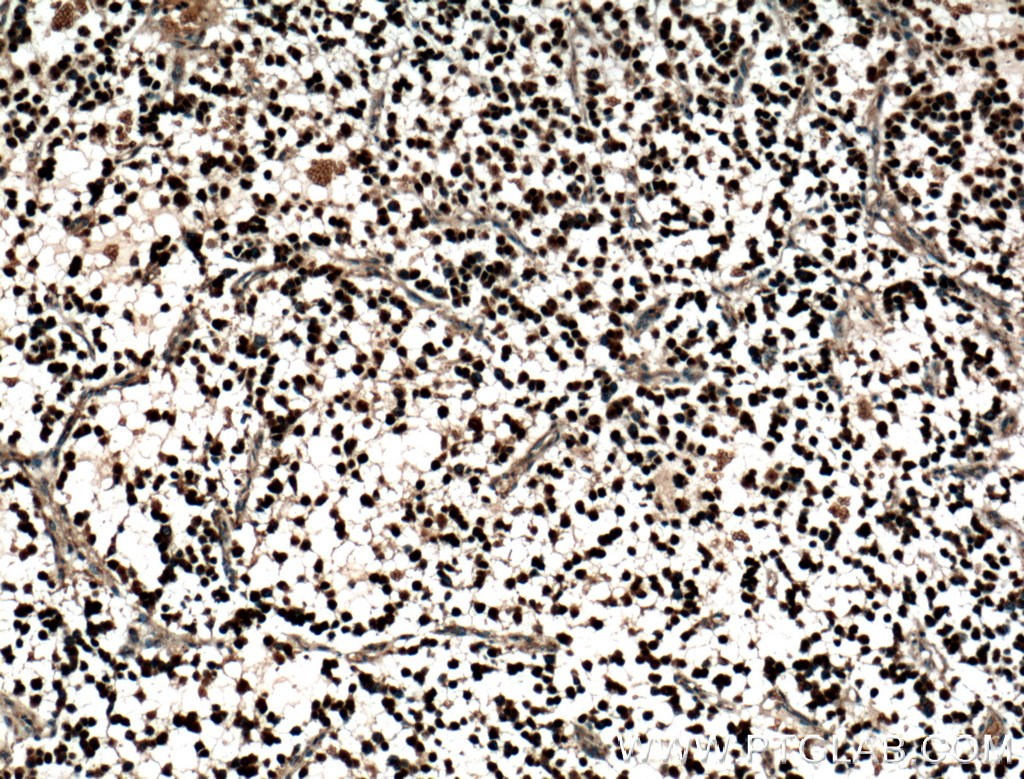 OLIG2 Polyclonal antibody