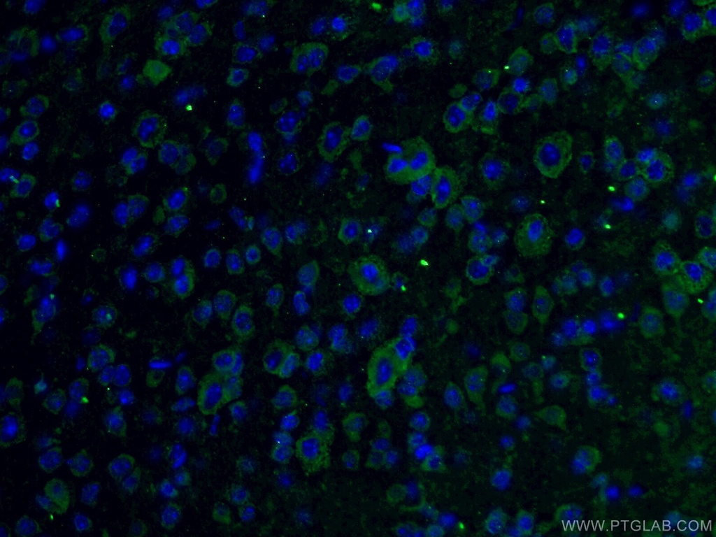 C9orf72 Polyclonal antibody