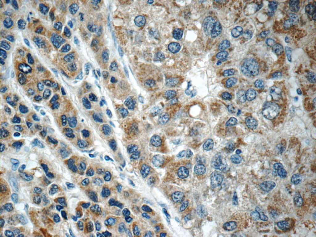 C11orf74 Polyclonal antibody