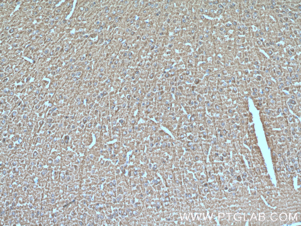 SNX32 Polyclonal antibody