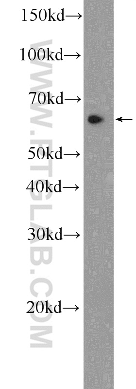 CCDC102A Polyclonal antibody