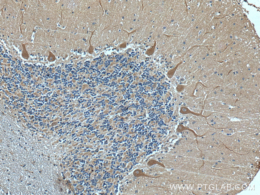 GRIK1 Polyclonal antibody