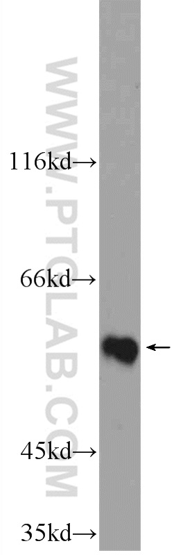 ZNF649 Polyclonal antibody