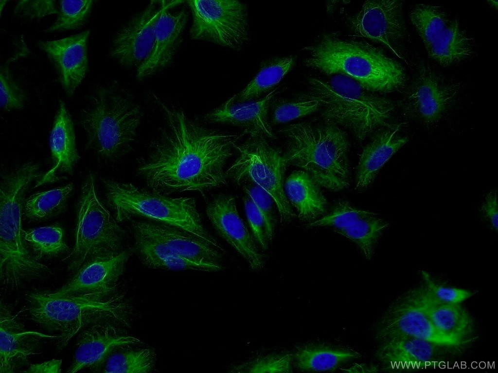RMND5B Polyclonal antibody