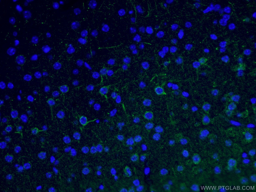NF-M Polyclonal antibody