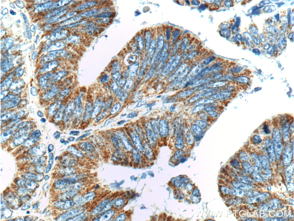 SMCO4 Polyclonal antibody