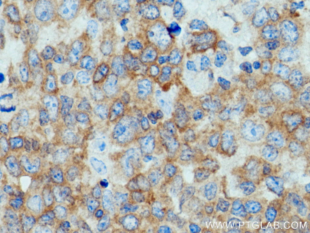 c-Cbl Polyclonal antibody