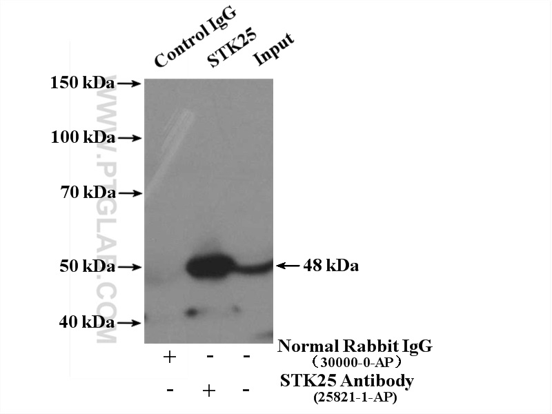 STK25 Polyclonal antibody