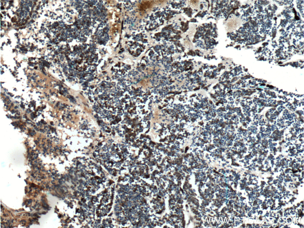 VSX2 Polyclonal antibody