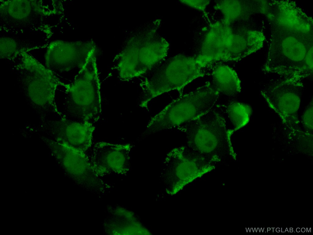 TFAP2E Polyclonal antibody