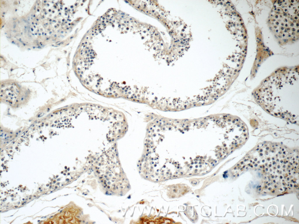 RGSL1 Polyclonal antibody