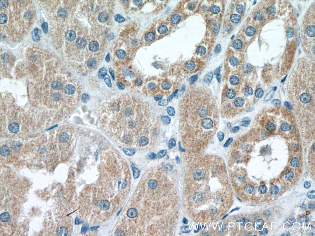 RAB11FIP3 Polyclonal antibody