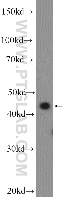 SUDS3 Polyclonal antibody