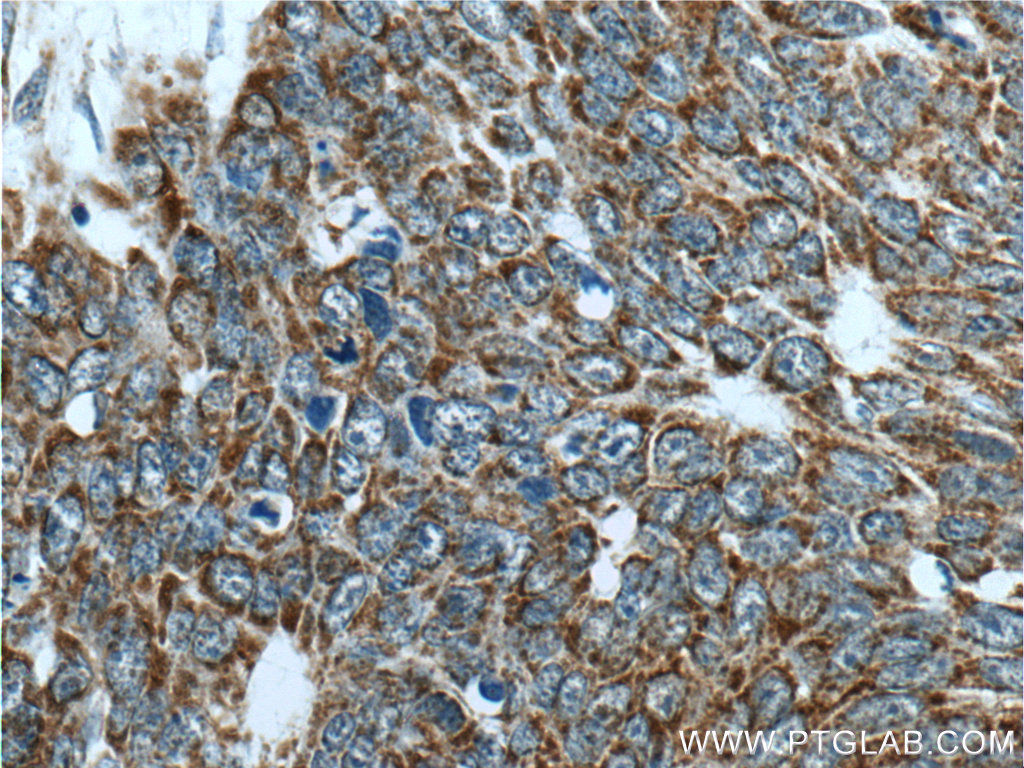 IDH3G Polyclonal antibody