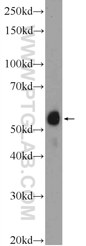 ACD Polyclonal antibody