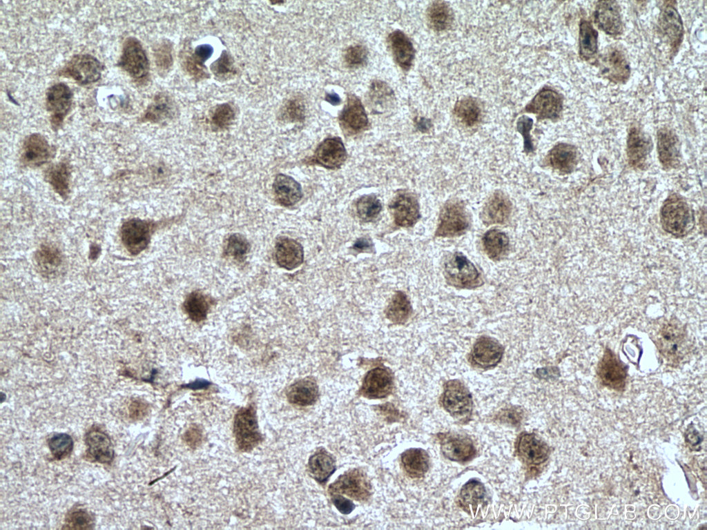 NR4A1 Polyclonal antibody