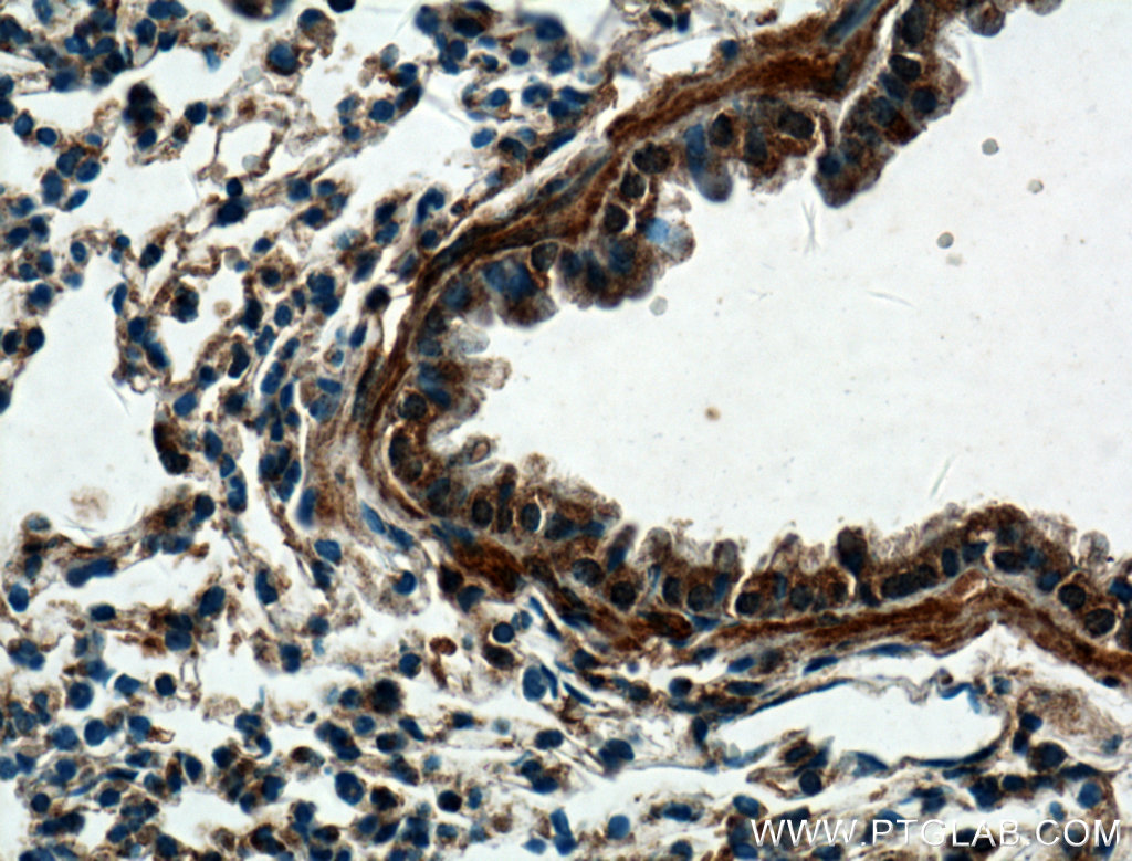 DECR2 Polyclonal antibody