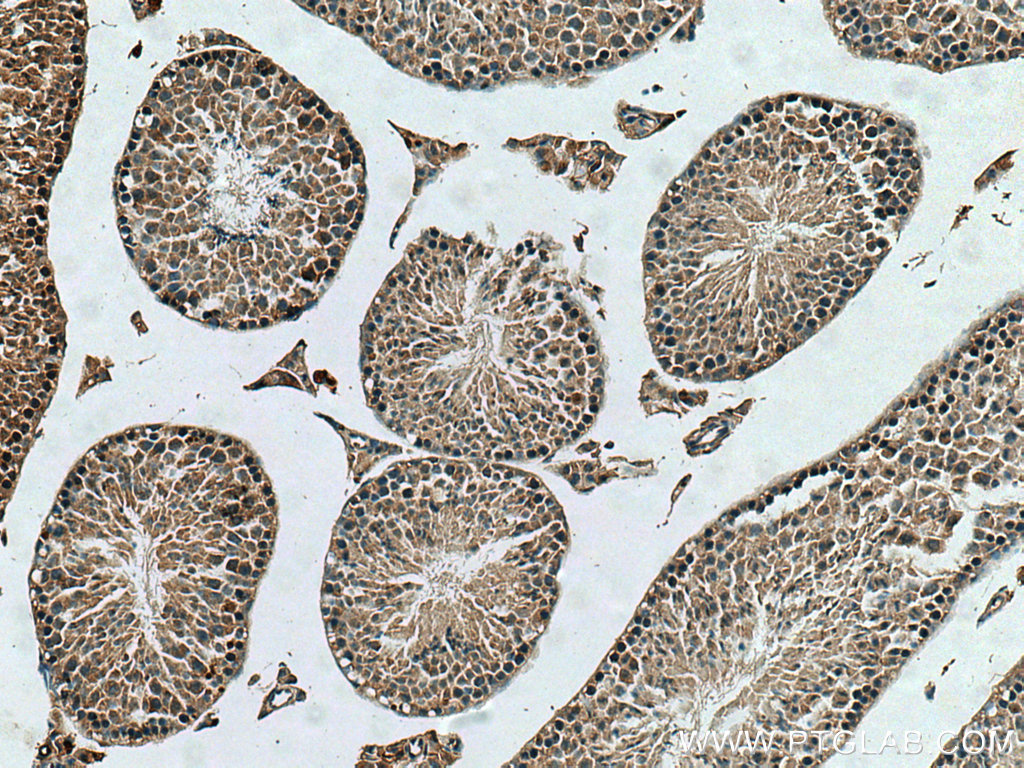 TUBGCP2 Polyclonal antibody