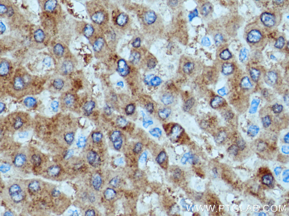 SAC3D1 Polyclonal antibody