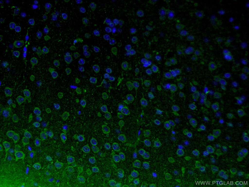 TH Polyclonal antibody