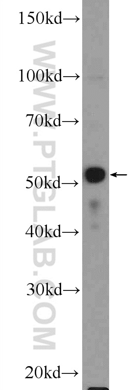 PLAGL1 Polyclonal antibody