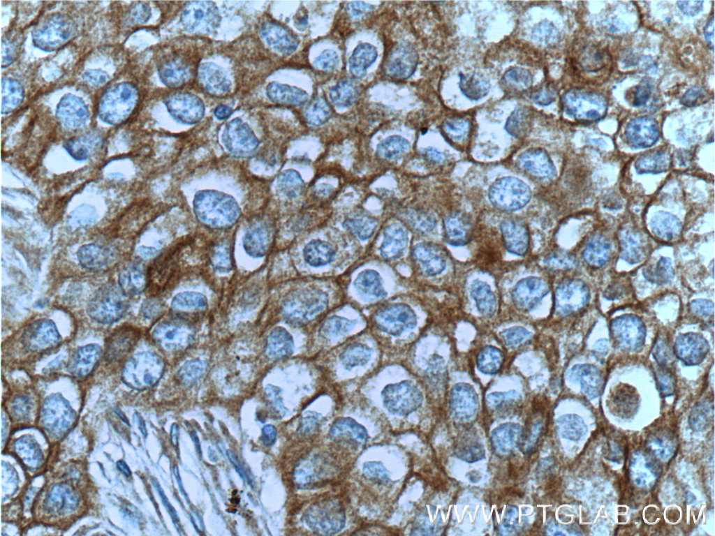 c-Met (Cytoplasmic) Polyclonal antibody