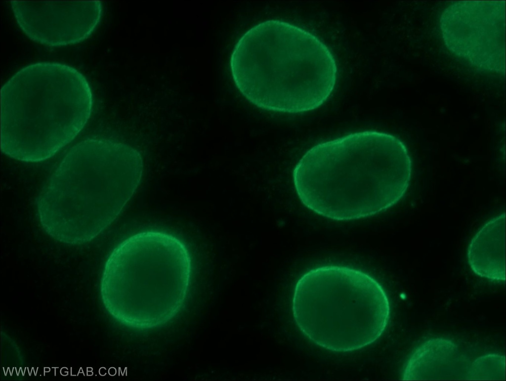 LY6G6F Polyclonal antibody