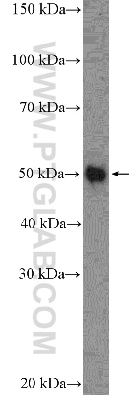 Whirlin Polyclonal antibody
