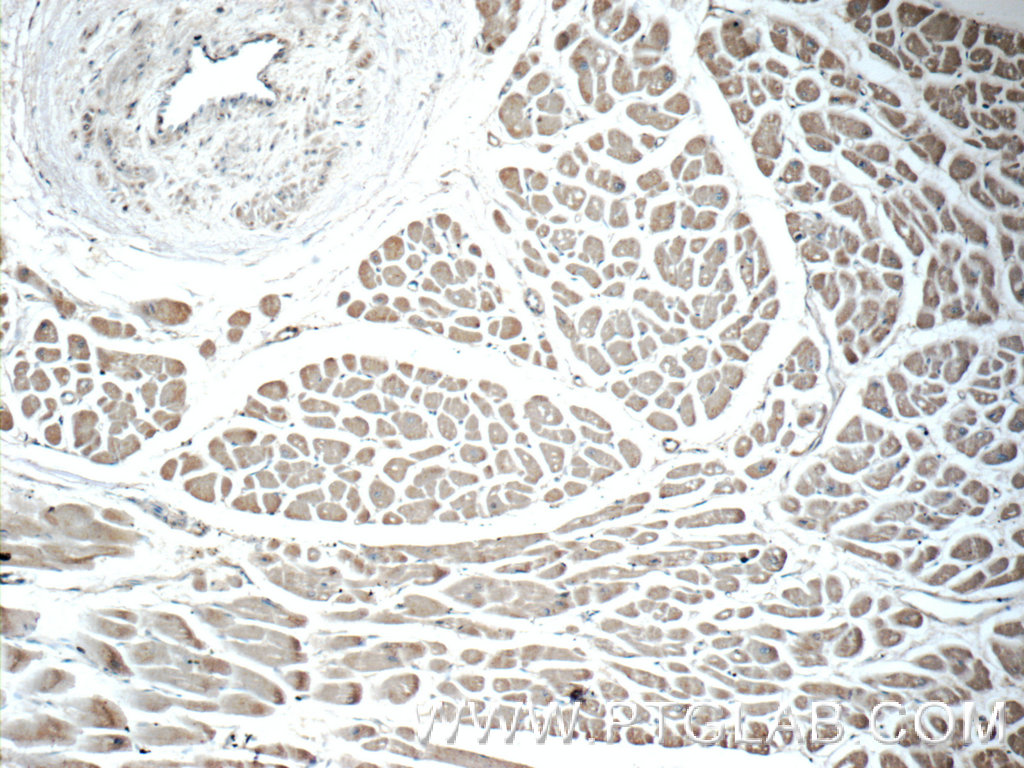 EDA Polyclonal antibody