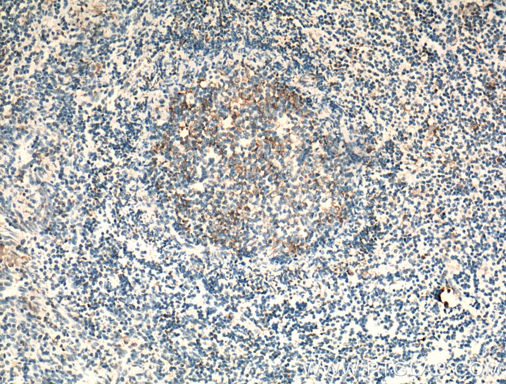 CCR7 Polyclonal antibody