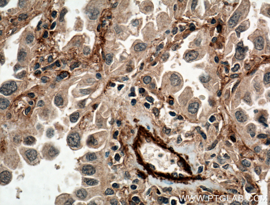 ADAM10 Polyclonal antibody