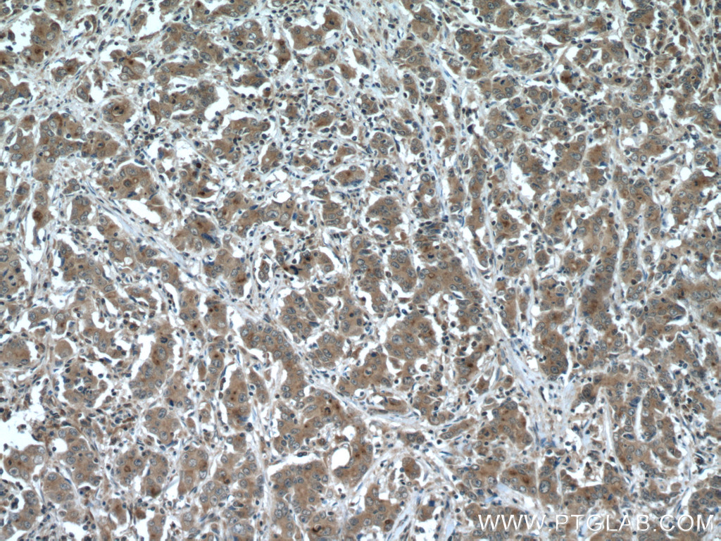 IQGAP3 Polyclonal antibody