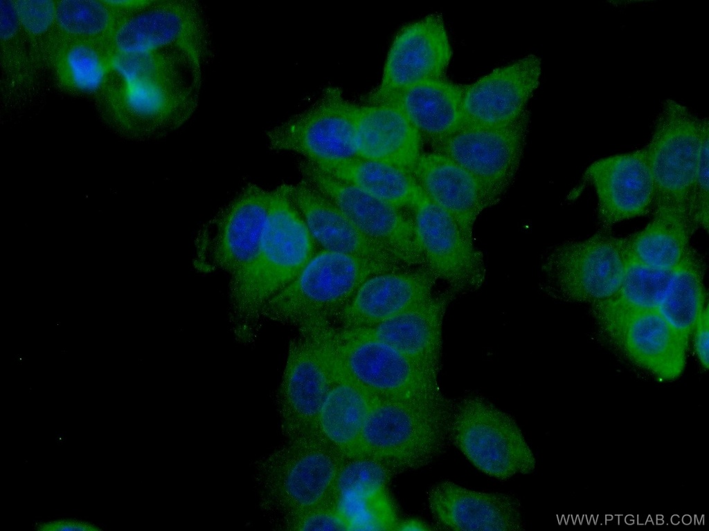 TCHP Polyclonal antibody